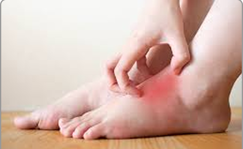 Inflammation